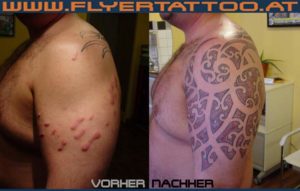Narben Cover up Tattoo